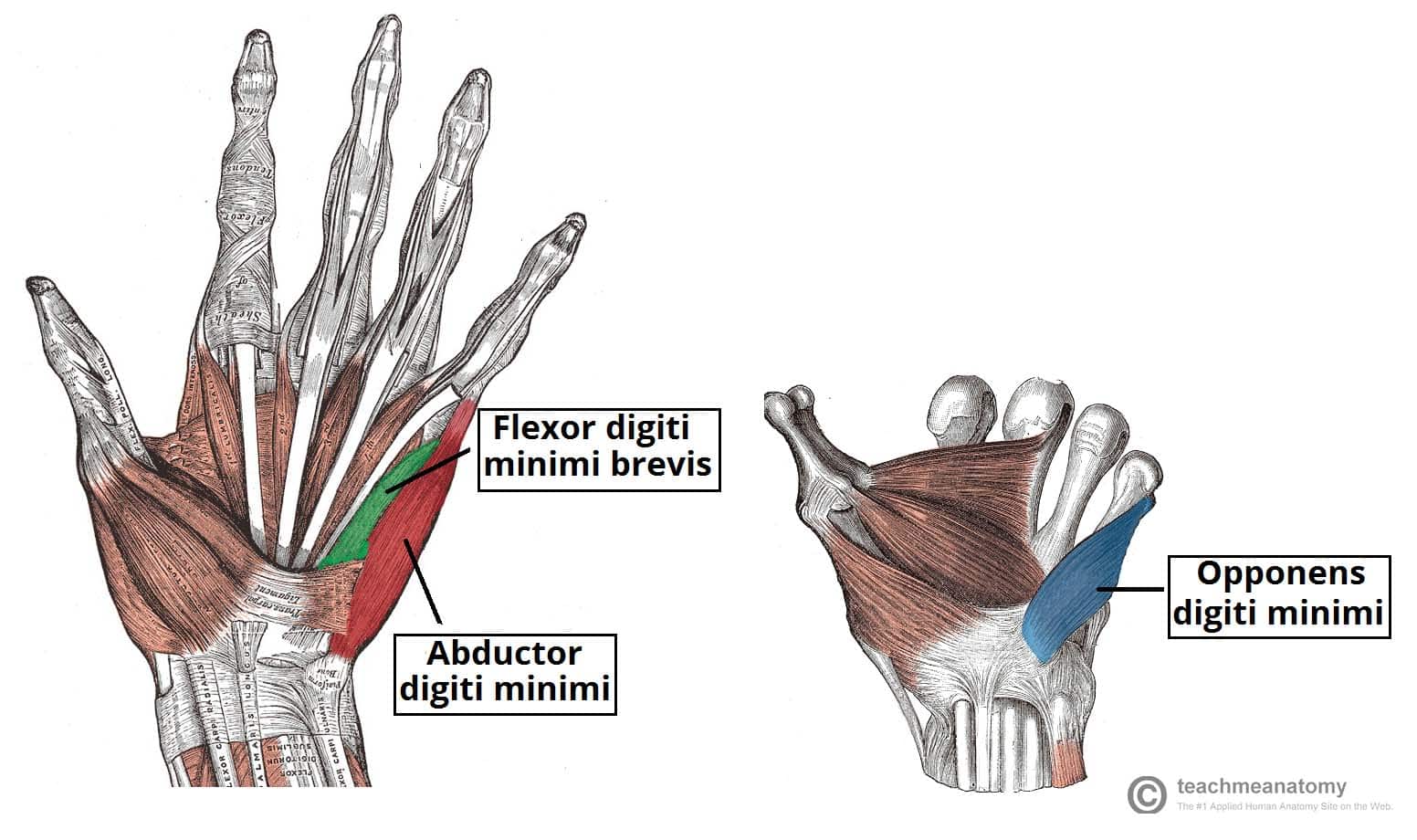 Figure 2 - Superficial and deep layers of the hypothenar muscles